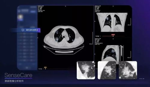 AI戰(zhàn)疫 人工智能在疫情防控中的軟件開(kāi)發(fā)與應(yīng)用
